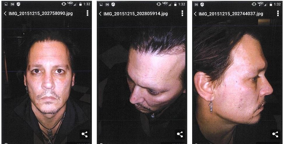 Τζόνι Ντεπ: ΦΩΤΟ από τους μώλωπες στο πρόσωπό του μετά τις επιθέσεις της Χερντ