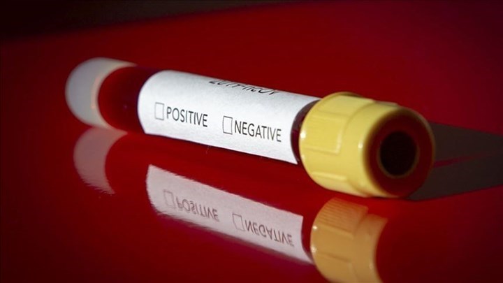 Κορονοϊός: Ενθαρρυντικά αποτελέσματα από εισπνεόμενο φάρμακο που περιέχει αντιϊκή πρωτεΐνη