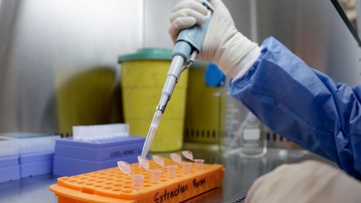 Κορονοϊός: Πάνω από 16 εκατ. τα κρούσματα παγκοσμίως –  Ανησυχία στη χώρα μας για διασπορά σε Αθήνα και Θεσσαλονίκη