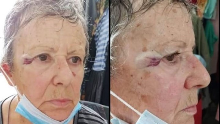 Αυλίδα: Επίθεση από ιερέα καταγγέλλει γυναίκα επειδή τάιζε τις γάτες έξω από εκκλησία – ΦΩΤΟ