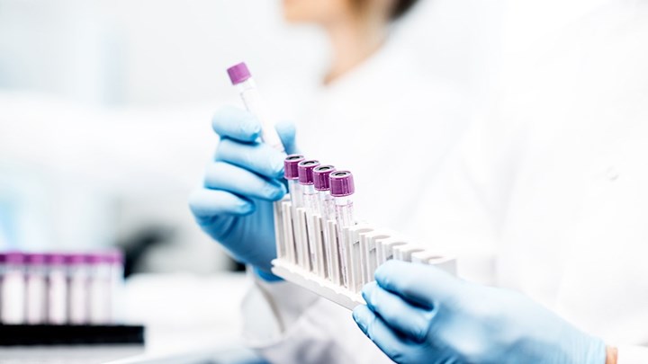 Κορονοϊός: Έλληνες επιστήμονες πίσω από “κοκτέιλ” αντισωμάτων που “φρενάρει” τον ιό