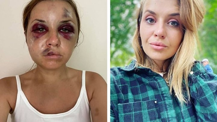 Τρόμος για Ουκρανή παρουσιάστρια – Άνδρας αποπειράθηκε να τη βιάσει μπροστά στο γιο της