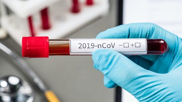 Κορονοϊός: Αναστάτωση στη Χαλκιδική – Βρέθηκαν 50 κρούσματα σε βιομηχανία τροφίμων – ΒΙΝΤΕΟ