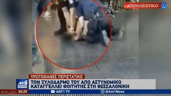 Θεσσαλονίκη: Φοιτητής καταγγέλλει τον ξυλοδαρμό του από αστυνομικό – Τι λένε πηγές της ΕΛ.ΑΣ. – ΒΙΝΤΕΟ