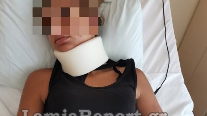 Λαμία: Άγριος ξυλοδαρμός 13χρονης από τρεις 17χρονες – Νοσηλεύεται στο νοσοκομείο – ΦΩΤΟ