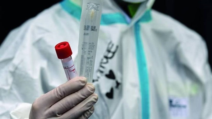 Οδηγίες για την έγκαιρη διάγνωση και τη διαχείριση κρουσμάτων COVID-19 στο ΕΚΠΑ