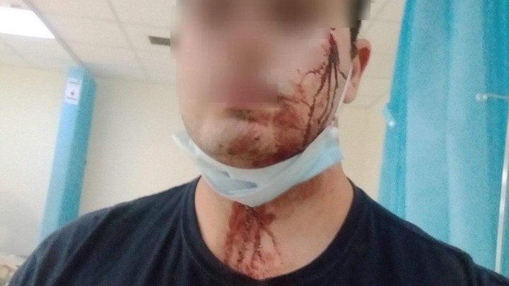 Μενίδι: Άγρια επίθεση σε αστυνομικούς επειδή τους χάλασαν το γλέντι – Δύο τραυματίες – ΦΩΤΟ