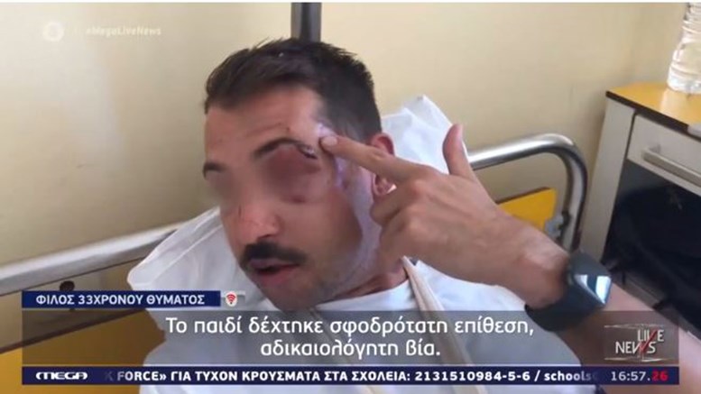 Ξυλοκόπησαν άγρια 33χρονο για να του κλέψουν το κινητό – Συγκλονίζει η εικόνα του – ΒΙΝΤΕΟ