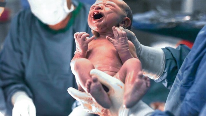 Ένα μωρό γεννιέται νεκρό κάθε 16 δευτερόλεπτα – Σοκάρει η έκθεση της UNICEF