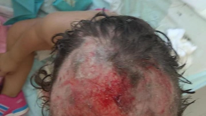 Κόρινθος: Σκυλιά επιτέθηκαν σε κοριτσάκι που έπαιζε σε παιδική χαρά – Σοκαριστική ΦΩΤΟ