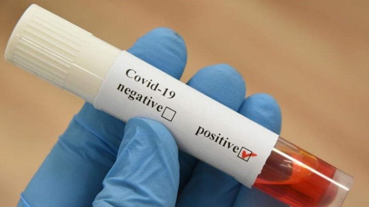 Πάτρα: Ο κορονοϊός “τρύπωσε” σε πολυκατοικία – Πληροφορίες για 15 κρούσματα