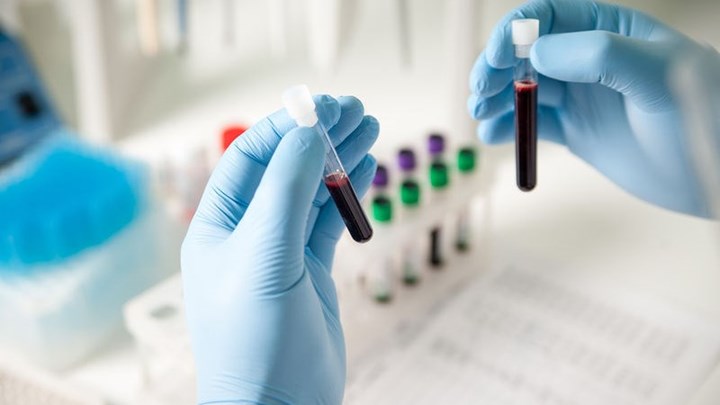 Κορονοϊός: Τεστ αίματος θα δείχνει στο μέλλον αν ένα εμβόλιο “δουλεύει”