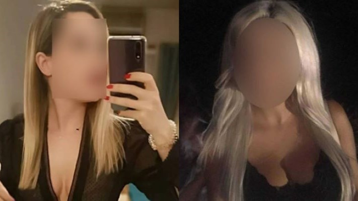 Επίθεση με βιτριόλι–Κεχαγιόγλου: Κωμικά τα σενάρια για σχέδιο επίθεσης και μέσα στο νοσοκομείο