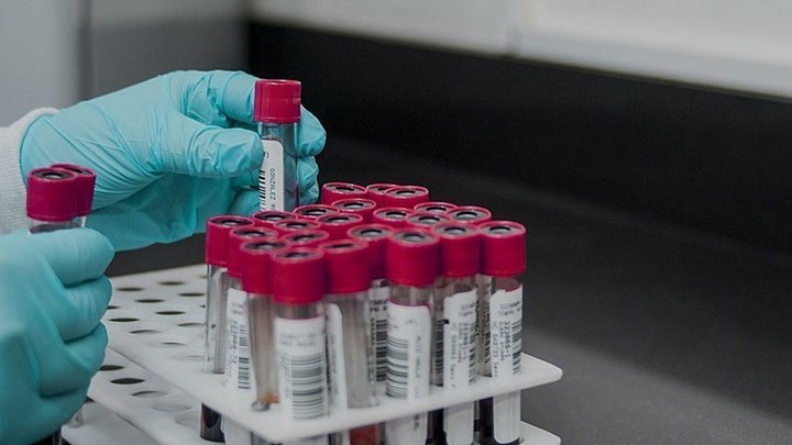 Κορονοϊός: Αυτές είναι οι 10 περιοχές της χώρας με τα περισσότερα νέα κρούσματα