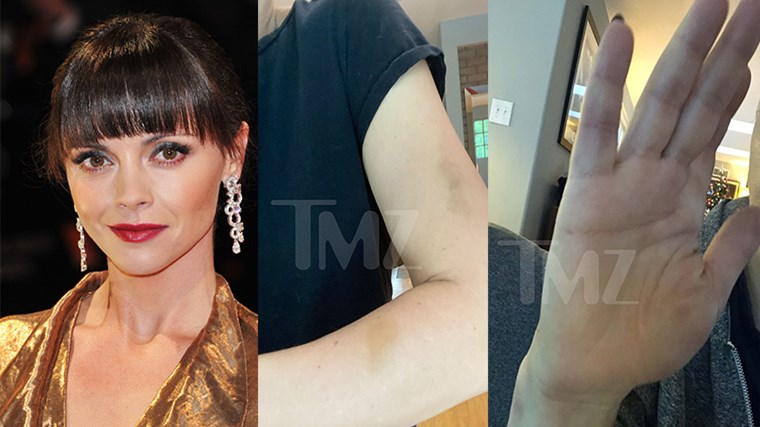 Κριστίνα Ρίτσι: Στη δημοσιότητα οι ΦΩΤΟ από τους μώλωπες που της προκάλεσε ο βίαιος σύζυγός της