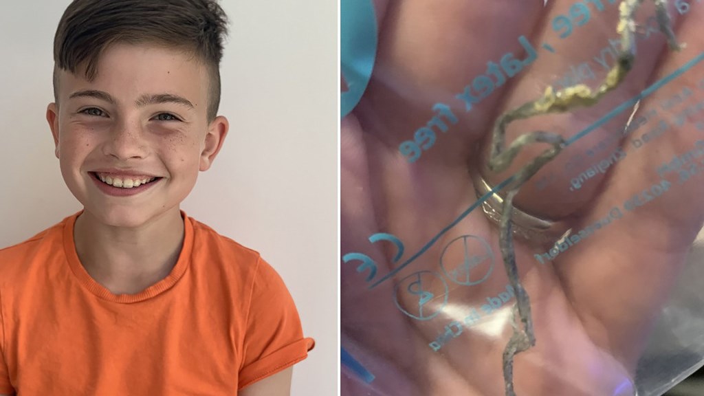 Viral το “σκουλήκι” που έβγαλαν από το αυτί 10χρονου – Ντροπιασμένη η μητέρα