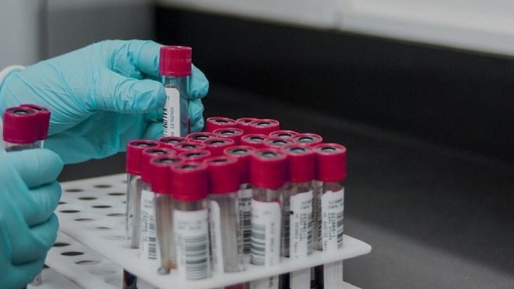 Κορονοϊός: Στα 12.000 τα ενεργά κρούσματα – Προβληματίζουν Πειραιάς και Δυτικός Τομέας Αθηνών