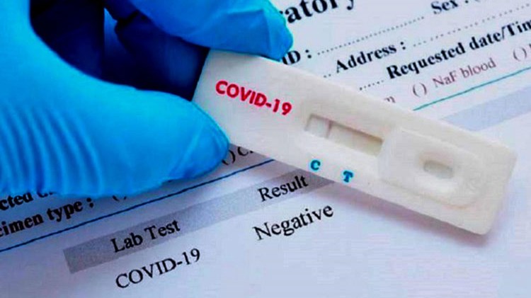Κορονοϊός: Υποχρεωτικό rapid test στο προσωπικό του ΕΣΥ που δεν έχει εμβολιασθεί