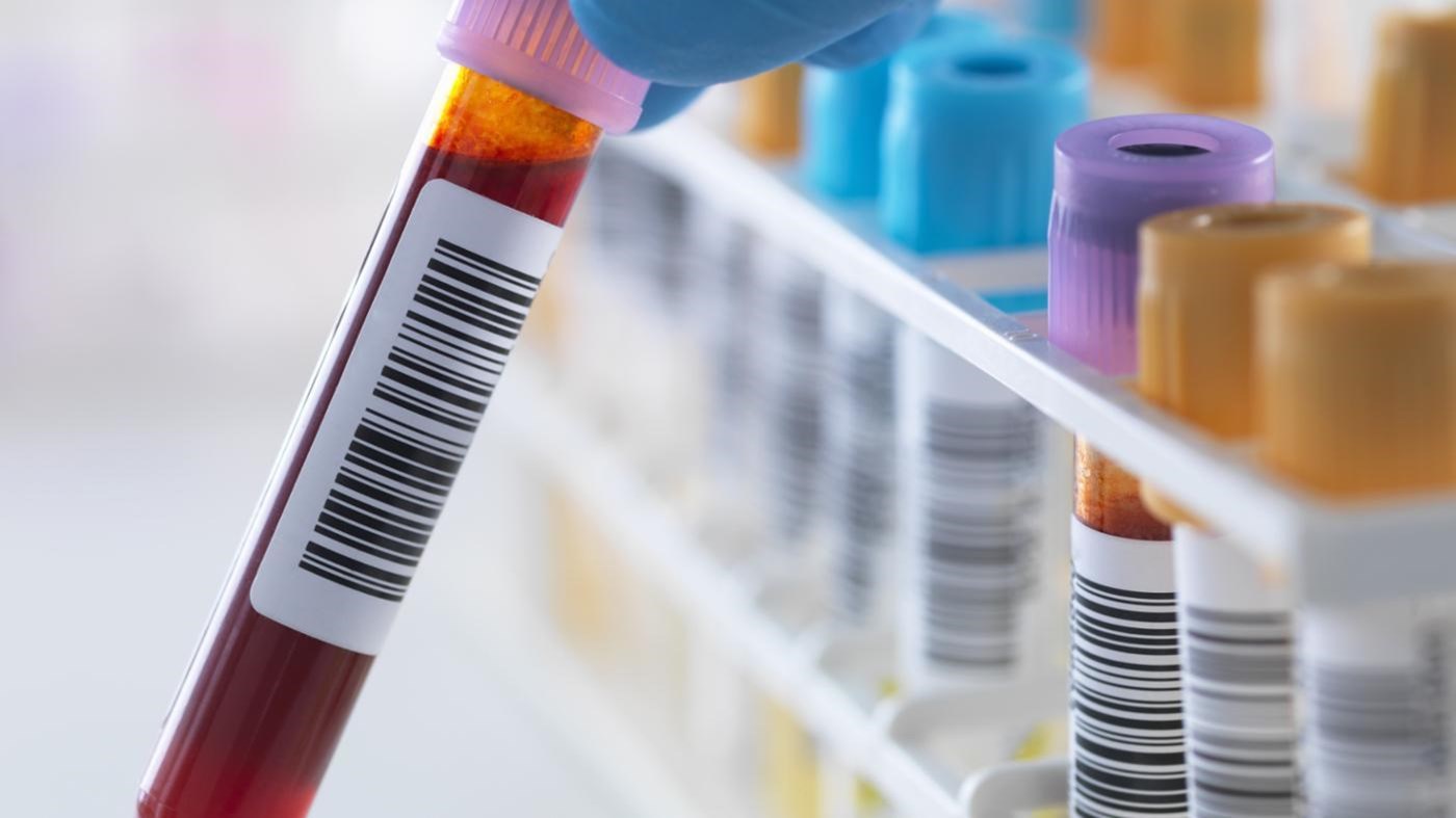 Κορονοϊός: Τι ρόλο παίζει τελικά η ομάδα αίματος – Νέα έρευνα