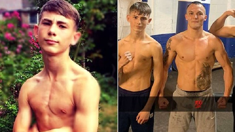 Άγρια επίθεση σε 18χρονο μποξέρ: Του έκοψαν το χέρι σε επίθεση με ματσέτα