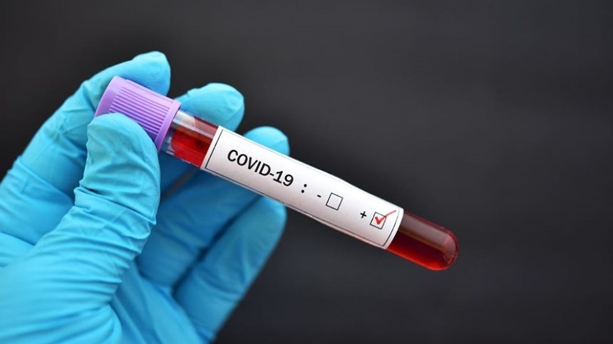 Κορονοϊός: Πόσο πιθανό είναι να ξανακολλήσουν οι 20άρηδες που έχουν ήδη νοσήσει – Τι δείχνει έρευνα