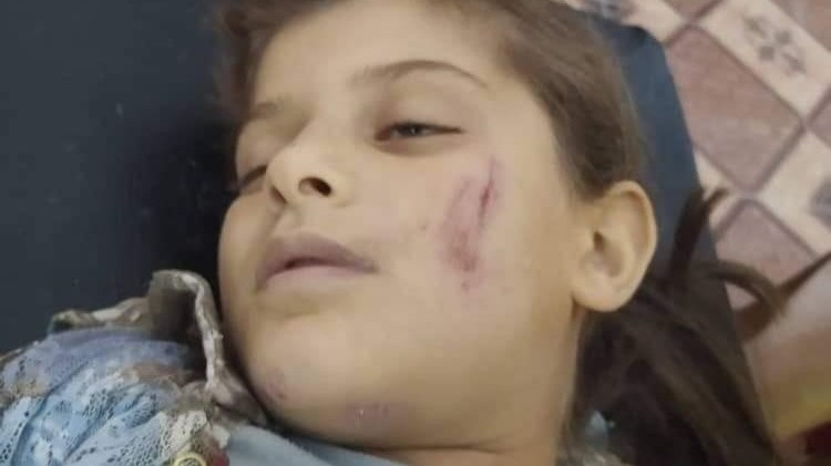 Συρία: Τουρκικό τεθωρακισμένο παρέσυρε και σκότωσε 8χρονη – ΦΩΤΟ