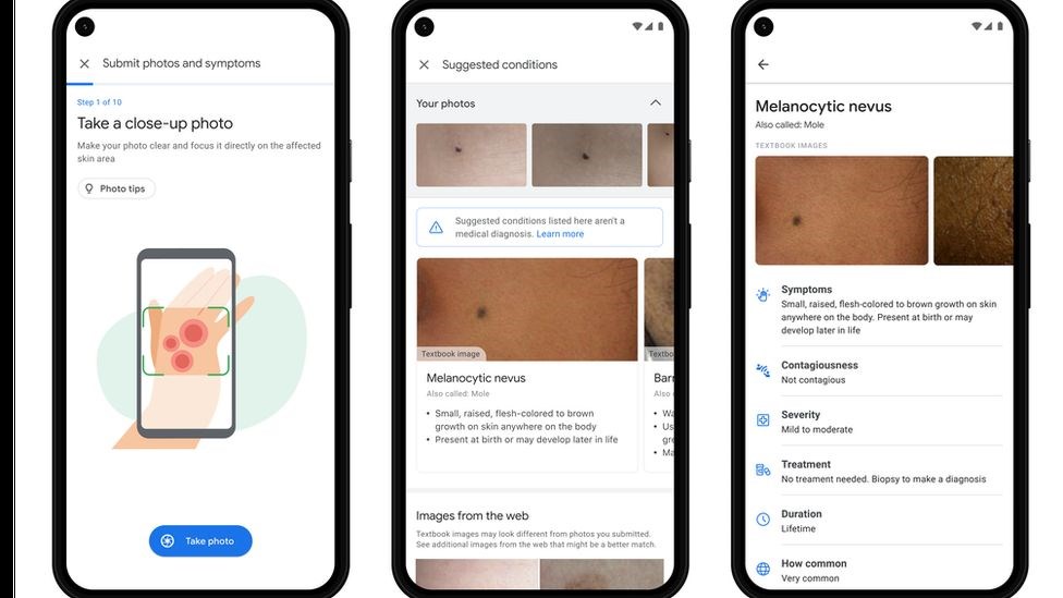 Dermatology Assist: Νέο έξυπνο εργαλείο από την Google – Πώς εντοπίζει βλάβες στο δέρμα