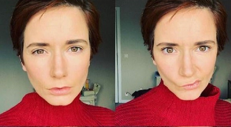 Κύπρος: Αυτό είναι το μοντέλο που πέθανε από θρομβοεμβολικό επεισόδιο μετά τον εμβολιασμό της