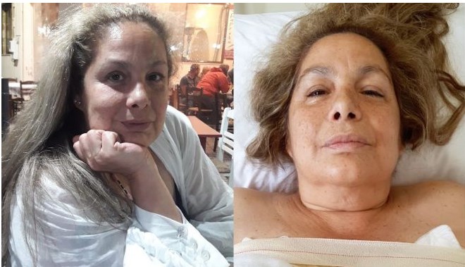 Τζένη Χειλουδάκη: Οι πρώτες ΦΩΤΟ μετά το σοβαρό χειρουργείο