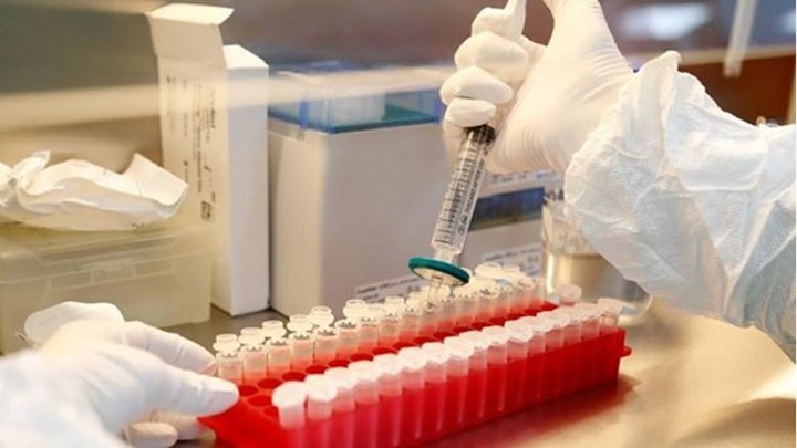 Κορονοϊός: Η  αντισωματική απάντηση έναντι της περιοχής RBD σε ασθενείς σε αιμοκάθαρση