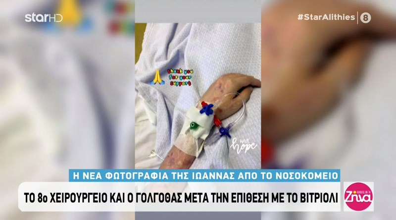 Επίθεση με βιτριόλι: Η νέα ΦΩΤΟ της Ιωάννας μέσα από το νοσοκομείο