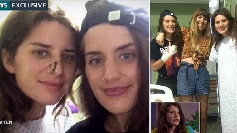 Δίδυμες έδωσαν μάχη με κροκόδειλο – Η ανατριχιαστική περιγραφή της δραματικής διάσωσης της αδελφής της