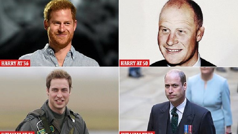 Πρίγκιπας Χάρι: Τι συμβαίνει με τα μαλλιά του; – Έτσι θα είναι όταν γίνει 50 ετών