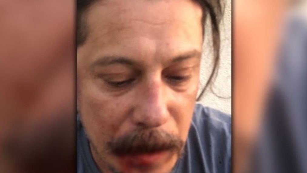 Θύμα άγριας επίθεσης έπεσε Τούρκος δημοσιογράφος, επικριτής του Ερντογάν – «Δεν θα γράψεις!»