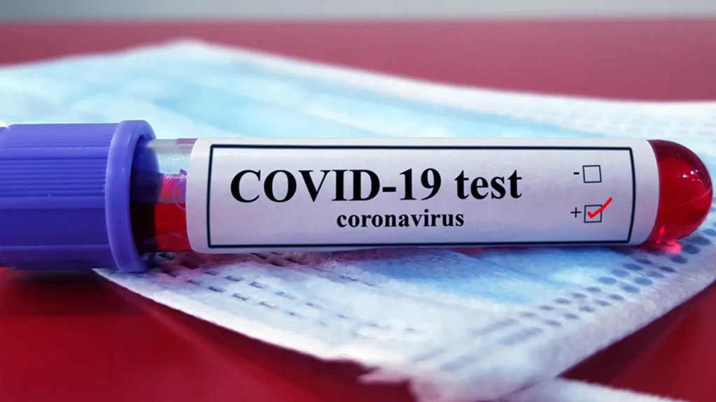 Σοκ με 2.327 νέα κρούσματα κορονοϊού – 2 νεκροί και 142 διασωληνωμένοι – Η γεωγραφική κατανομή