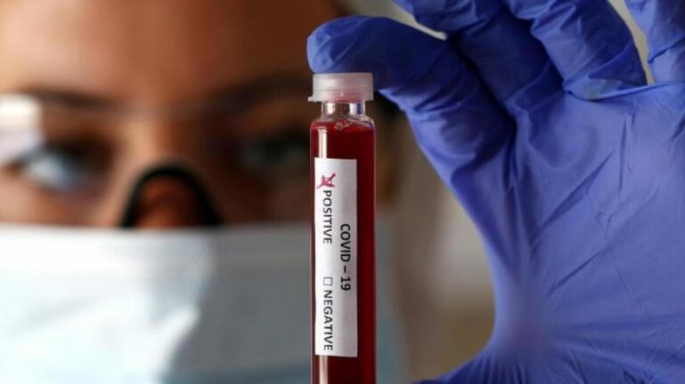 Κορονοϊός: Διάχυση της διασποράς σε Κρήτη, Θεσσαλία, Ήπειρο – Ο ρόλος των μετακινήσεων από νομό σε νομό