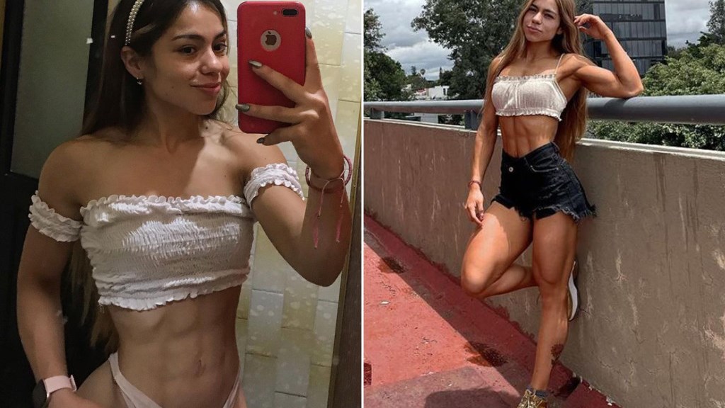 Ιnfluencer έπαθε καρδιακή ανακοπή κατά τη διάρκεια επέμβασης – Ήθελε να μειώσει τον ιδρώτα της