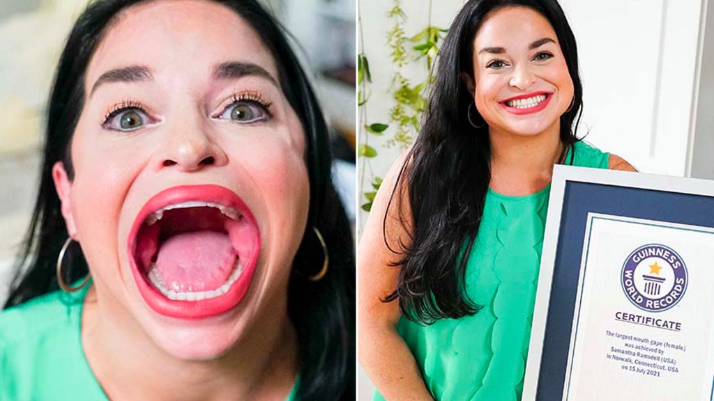 Viral η γυναίκα με το μεγαλύτερο στόμα στον κόσμο