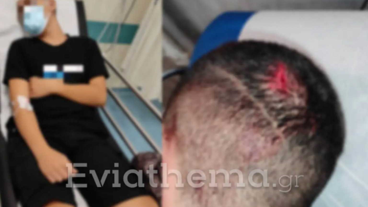 Σοκ στο Αλιβέρι: Θύμα ξυλοδαρμού 15χρονος από ενήλικο με μαύρη ζώνη στις πολεμικές τέχνες