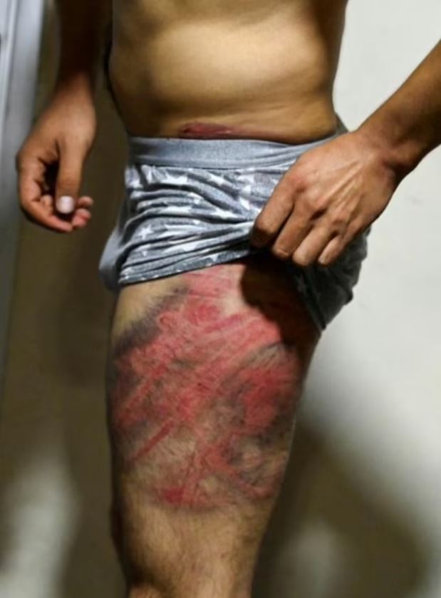 Αφγανιστάν - δημοσιογράφοι