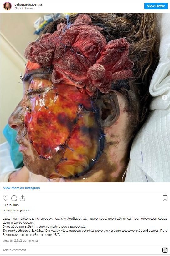 βιτριόλι ιωάννα