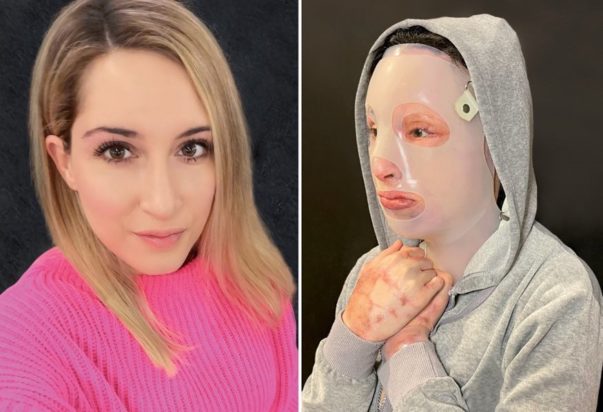 Ιωάννα επίθεση με βιτριόλι