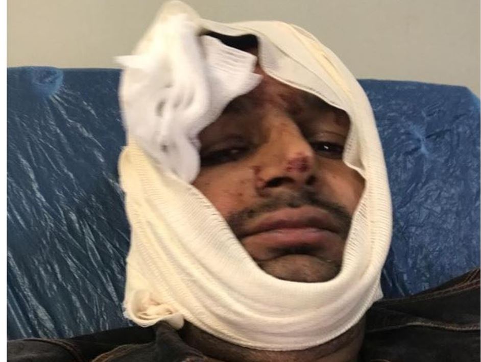 Παλιά Κοκκινιά-Μετανάστες