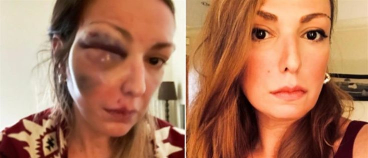 Στεφανία Τζαφέρη κακοποίηση