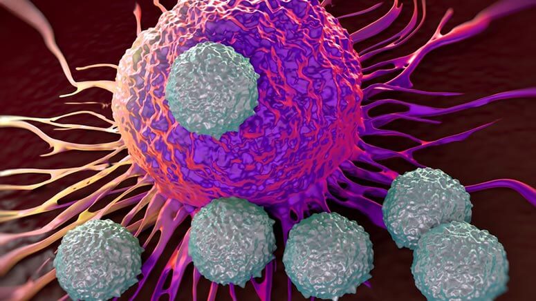 πολλαπλό μυέλωμα