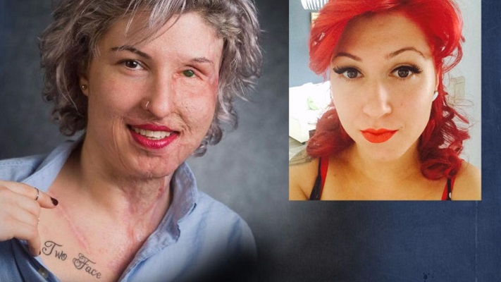 βανέσσα βιτριόλι