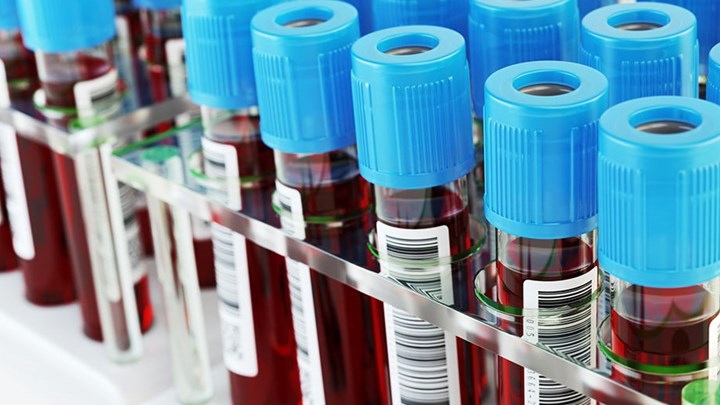 Ημέρα ευαισθητοποίησης για την σιδηροπενική αναιμία