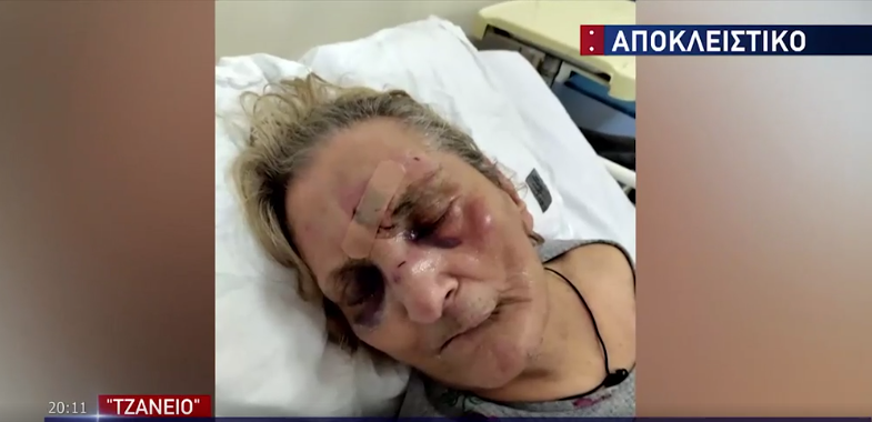 Εικόνες σοκ στο “Τζάνειο”: Προσέλαβε αποκλειστική για να προσέξει τη μητέρα της και τη βρήκε σακατεμένη