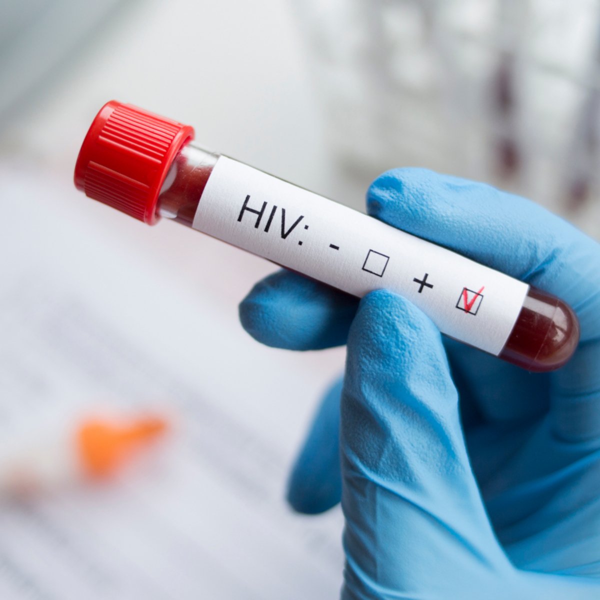 HIV
