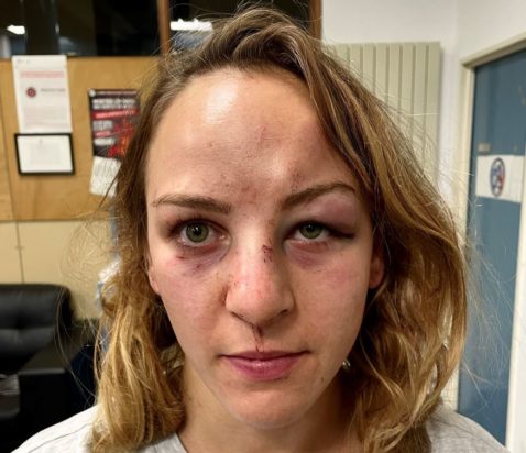 Γαλλία-Καταγγελία